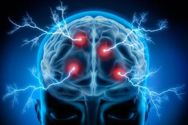 Pain and the brain